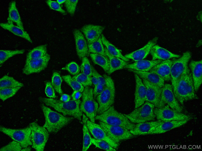 UPF1 Antibody in Immunocytochemistry (ICC/IF)