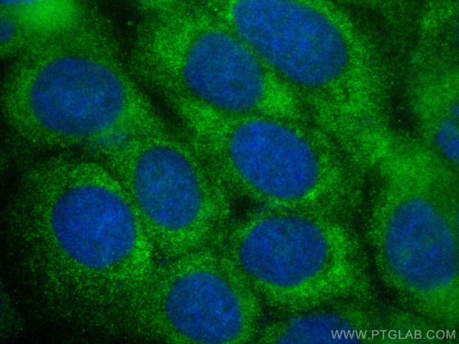 RAB27B Antibody in Immunocytochemistry (ICC/IF)