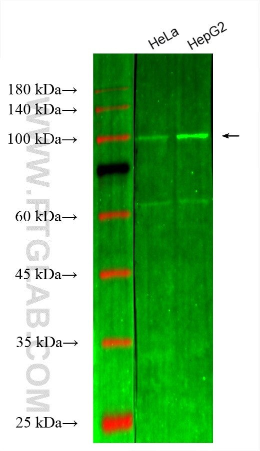 Hexokinase 2 Antibody in Western Blot (WB)