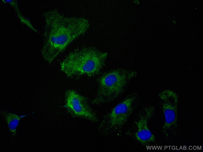EPO Antibody in Immunocytochemistry (ICC/IF)