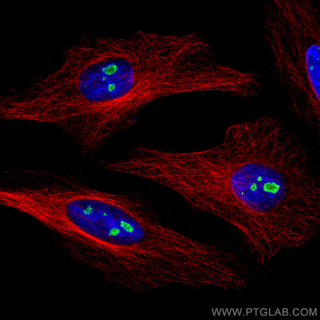 FBL Antibody in Immunocytochemistry (ICC/IF)