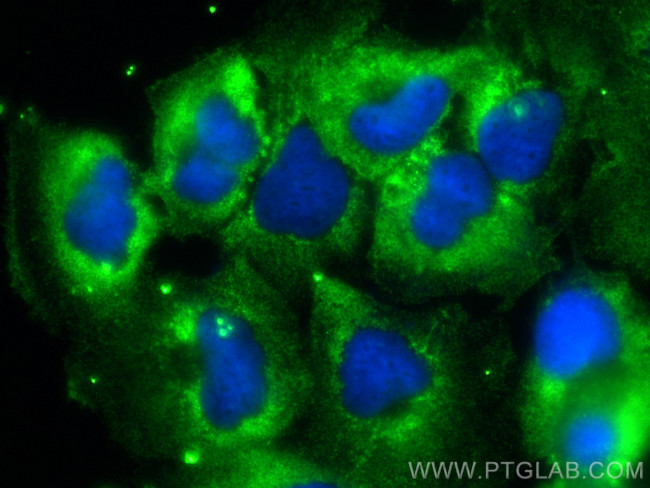 Neuroserpin Antibody in Immunocytochemistry (ICC/IF)