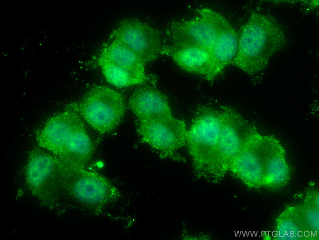 KIF5A Antibody in Immunocytochemistry (ICC/IF)
