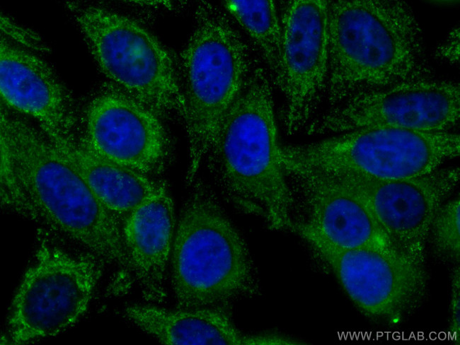 COMMD1 Antibody in Immunocytochemistry (ICC/IF)