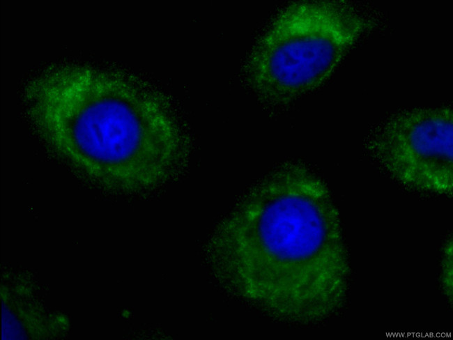 FMO2 Antibody in Immunocytochemistry (ICC/IF)