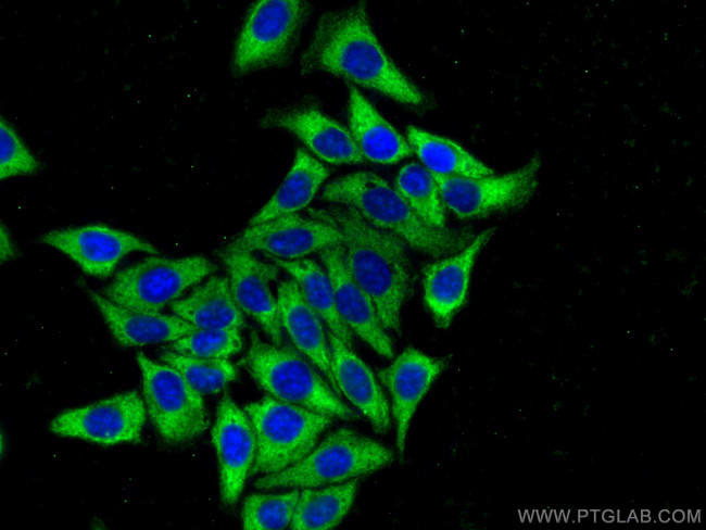 Ribosomal protein L4 Antibody in Immunocytochemistry (ICC/IF)