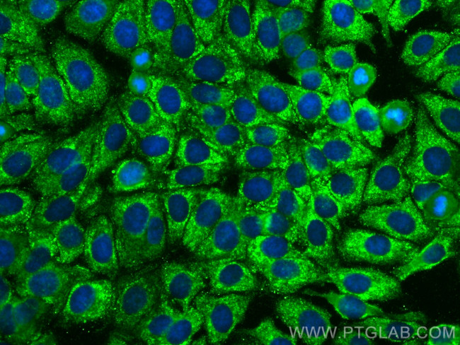 HAI-1 Antibody in Immunocytochemistry (ICC/IF)