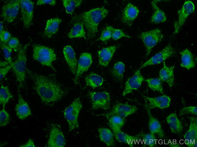 NEU1 Antibody in Immunocytochemistry (ICC/IF)