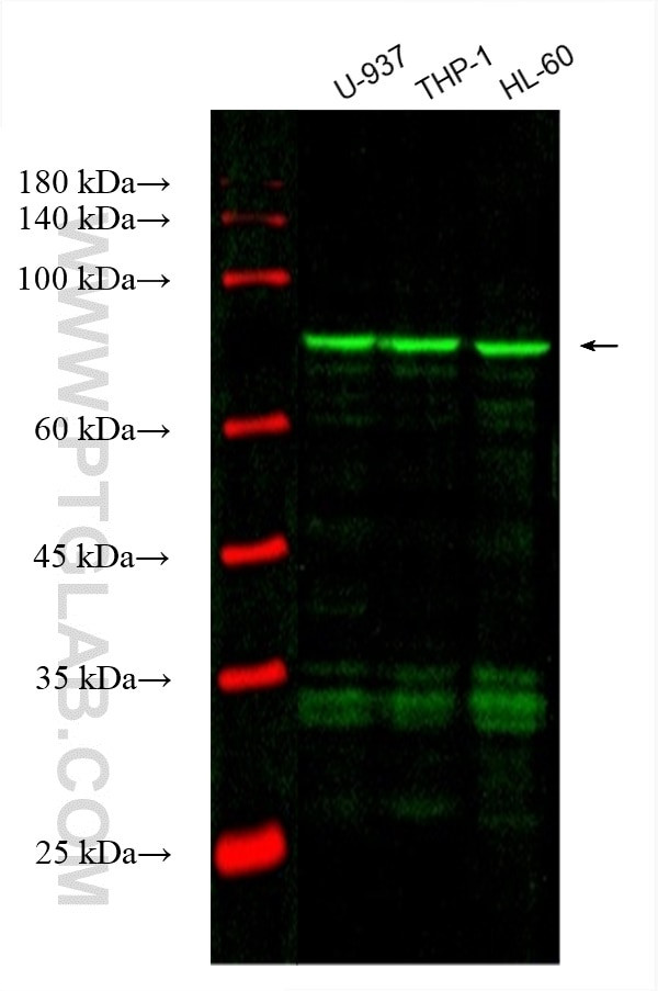 ADRBK1 Antibody in Western Blot (WB)