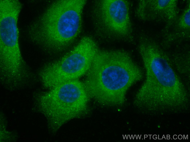 IDE Antibody in Immunocytochemistry (ICC/IF)