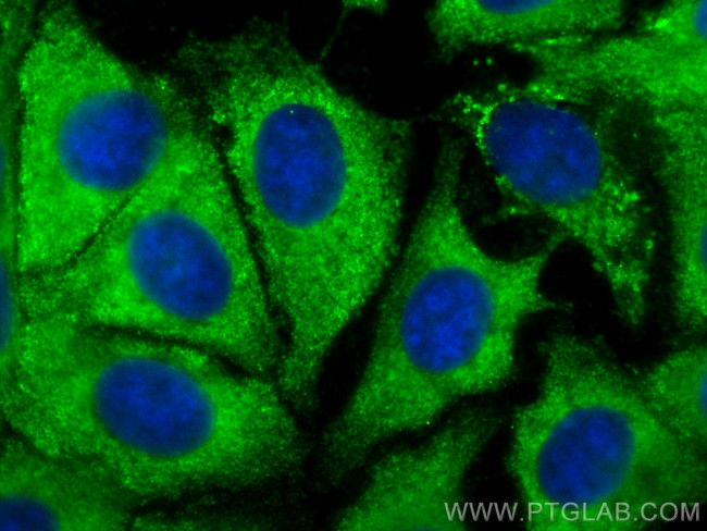 VEGFC Antibody in Immunocytochemistry (ICC/IF)