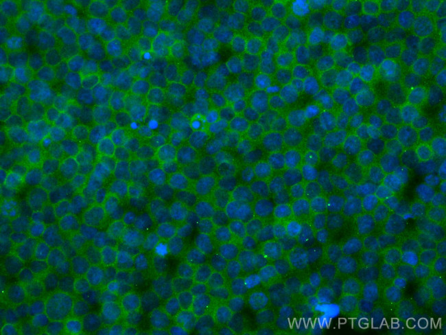 RIAM, APBB1IP Antibody in Immunocytochemistry (ICC/IF)