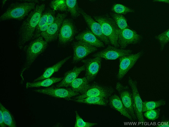 RANGAP1 Antibody in Immunocytochemistry (ICC/IF)