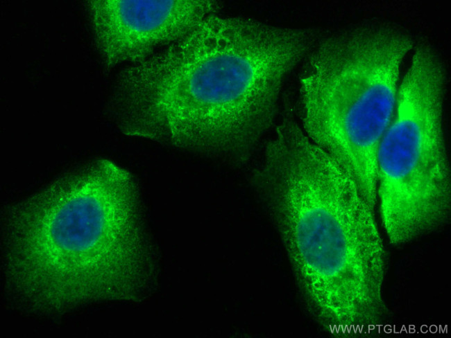 ACLY Antibody in Immunocytochemistry (ICC/IF)
