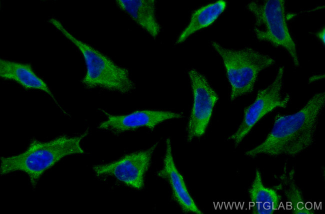 CUL2 Antibody in Immunocytochemistry (ICC/IF)