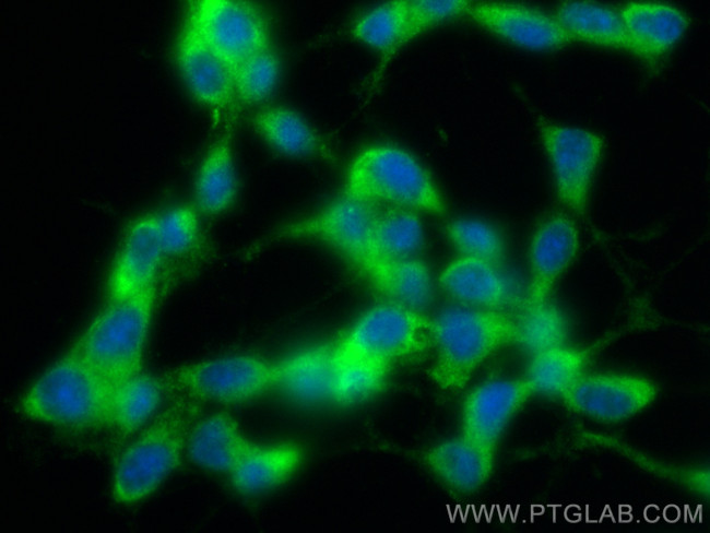 STMN2 Antibody in Immunocytochemistry (ICC/IF)