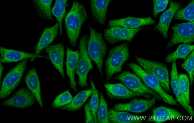 RPL17 Antibody in Immunocytochemistry (ICC/IF)