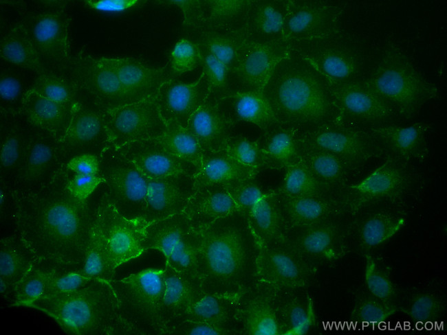 MRP1 Antibody in Immunocytochemistry (ICC/IF)