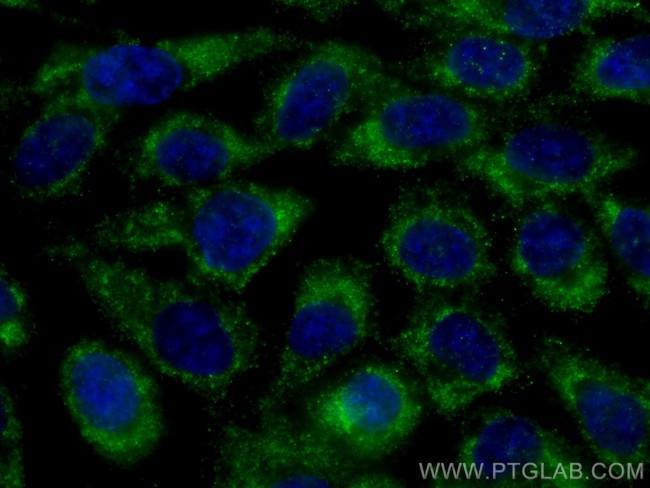GNMT Antibody in Immunocytochemistry (ICC/IF)