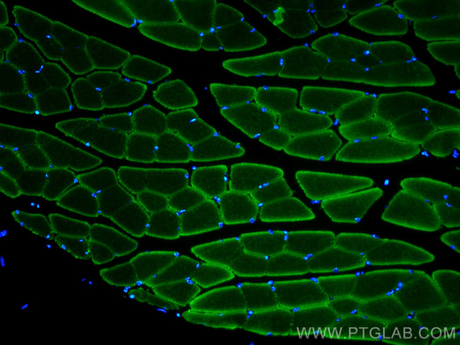 MYH1 Antibody in Immunohistochemistry (PFA fixed) (IHC (PFA))