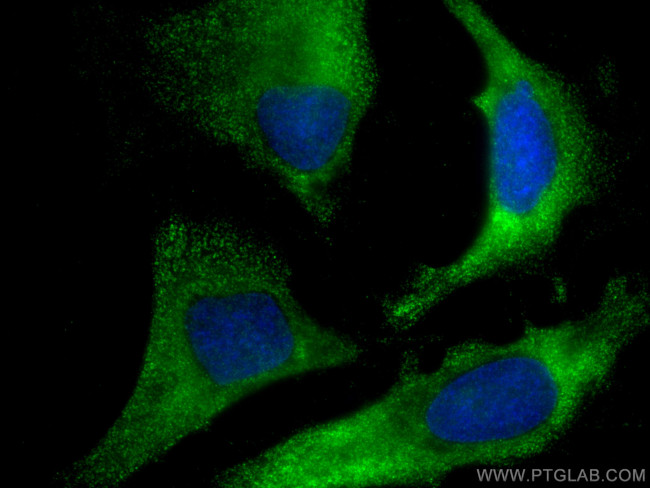 USP8 Antibody in Immunocytochemistry (ICC/IF)