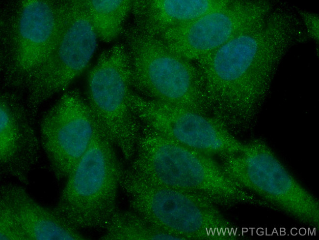 MAP2K4 Antibody in Immunocytochemistry (ICC/IF)