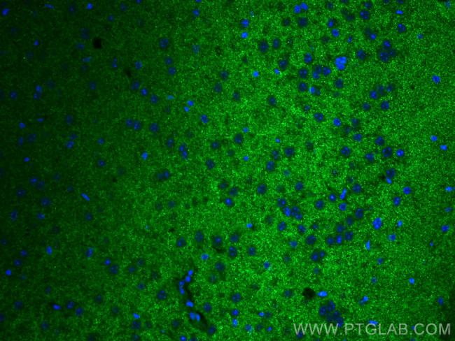 SYNPO Antibody in Immunohistochemistry (PFA fixed) (IHC (PFA))