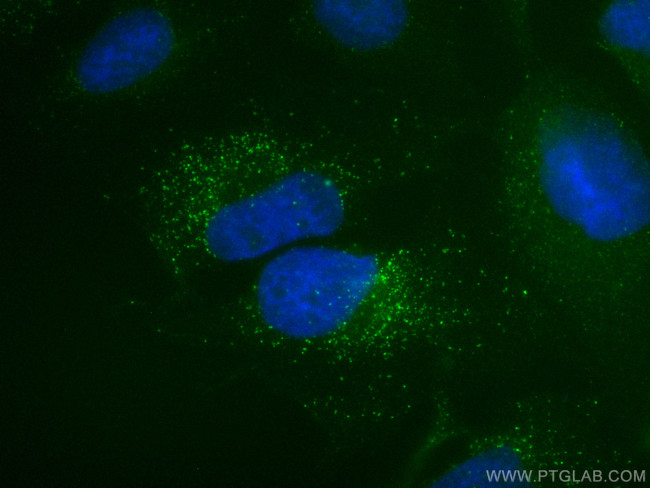 PNPLA3 Antibody in Immunocytochemistry (ICC/IF)