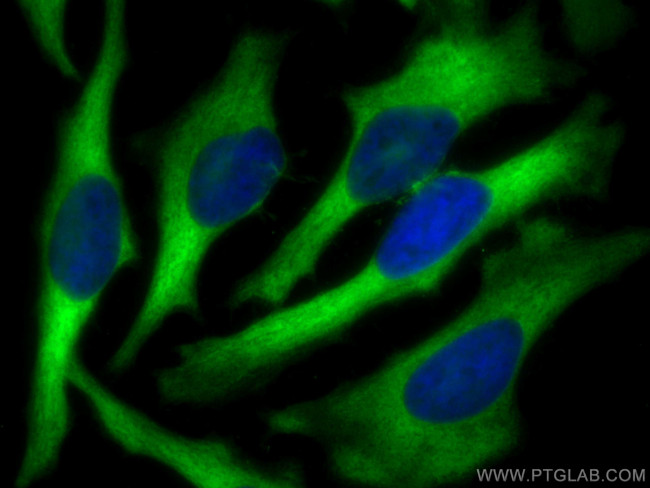 Profilin 1 Antibody in Immunocytochemistry (ICC/IF)