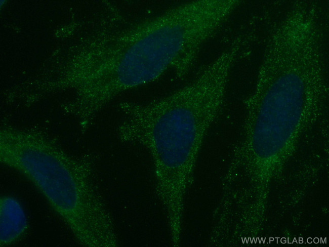 Caspase 4 Antibody in Immunocytochemistry (ICC/IF)