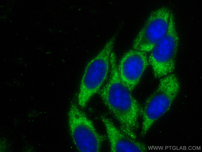 CCT5 Antibody in Immunocytochemistry (ICC/IF)