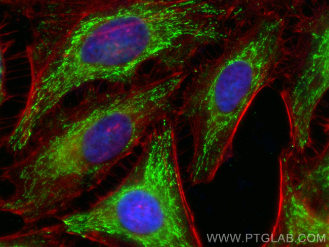 MAT1A Antibody in Immunocytochemistry (ICC/IF)