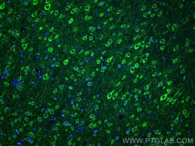 MAP1B Antibody in Immunohistochemistry (PFA fixed) (IHC (PFA))