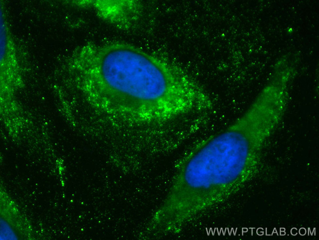 CYP20A1 Antibody in Immunocytochemistry (ICC/IF)