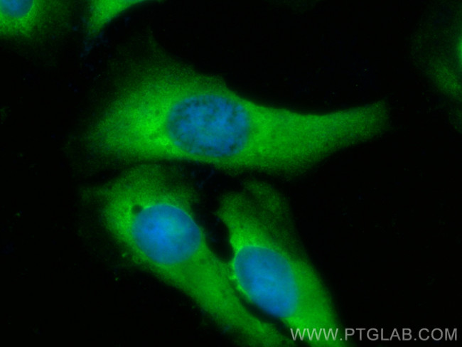 CCT4 Antibody in Immunocytochemistry (ICC/IF)