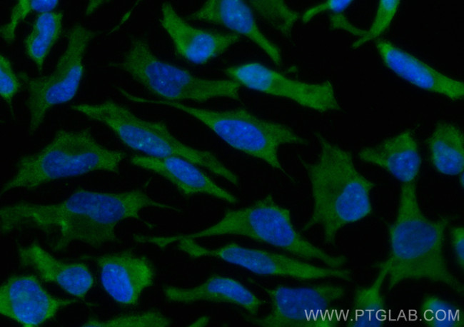 UBC12 Antibody in Immunocytochemistry (ICC/IF)