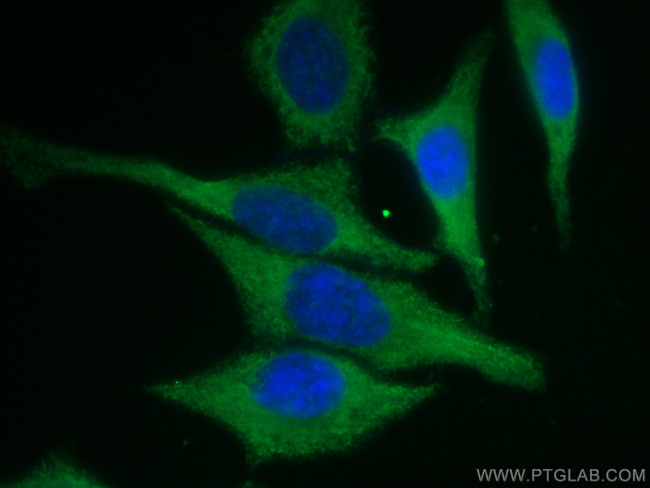 EEF1A1 Antibody in Immunocytochemistry (ICC/IF)