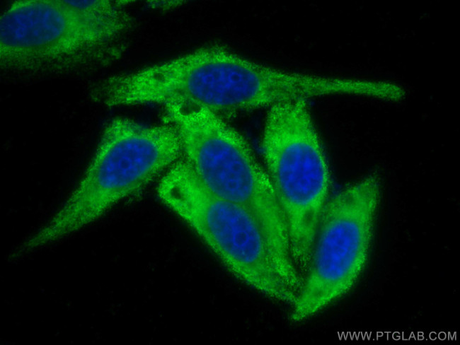 GNB3 Antibody in Immunocytochemistry (ICC/IF)