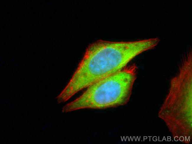 PER2 (isoform 1) Antibody in Immunocytochemistry (ICC/IF)