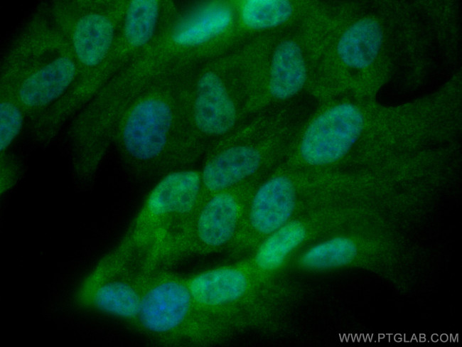 RB1 Antibody in Immunocytochemistry (ICC/IF)