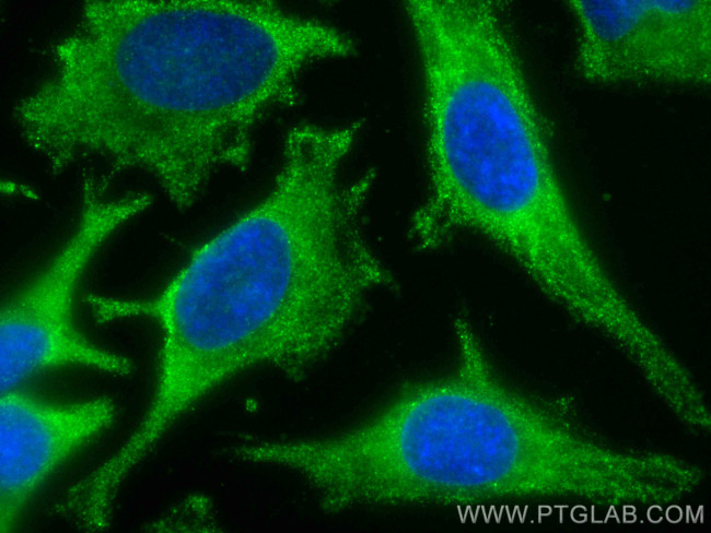 RAB8A Antibody in Immunocytochemistry (ICC/IF)