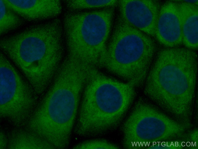 CCT8 Antibody in Immunocytochemistry (ICC/IF)
