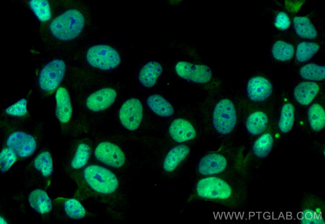 SUMO1 Antibody in Immunocytochemistry (ICC/IF)