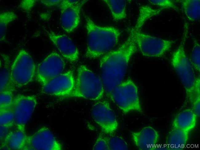 PAK6 Antibody in Immunocytochemistry (ICC/IF)