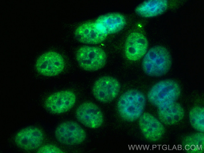 Beta Arrestin 1 Antibody in Immunocytochemistry (ICC/IF)