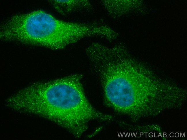 Calumenin Antibody in Immunocytochemistry (ICC/IF)