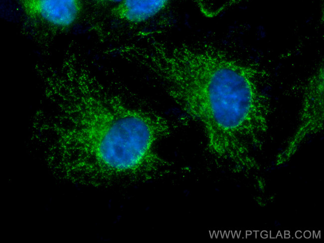 PRX5 Antibody in Immunocytochemistry (ICC/IF)