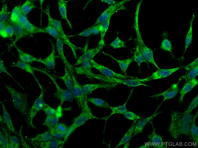 FAAH Antibody in Immunocytochemistry (ICC/IF)