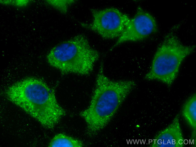 GSTM3 Antibody in Immunocytochemistry (ICC/IF)