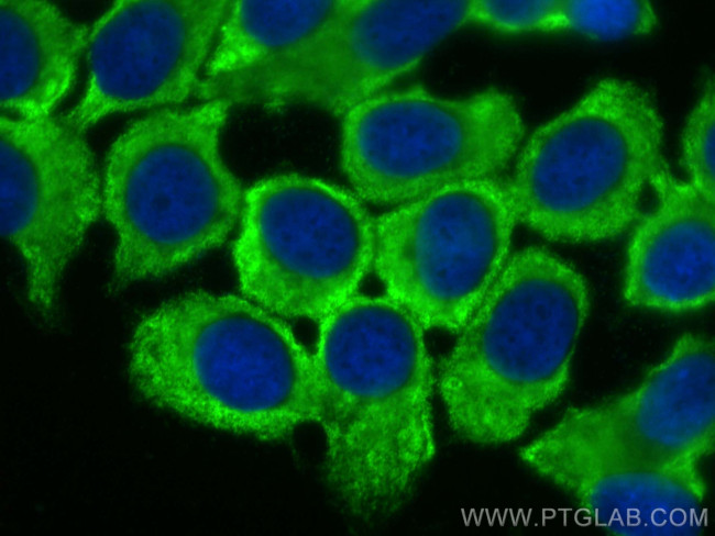 CCDC6 Antibody in Immunocytochemistry (ICC/IF)